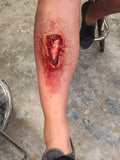 Grade III Compound Fracture Mold